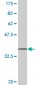 SCYL1 Antibody (monoclonal) (M02)